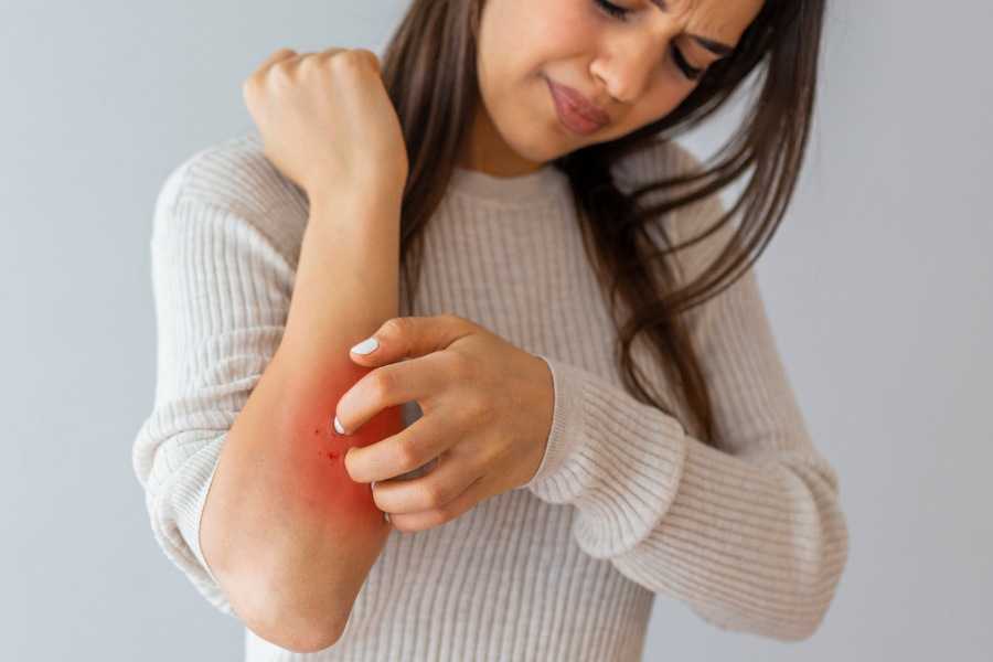 Skin Rashes & Conditions